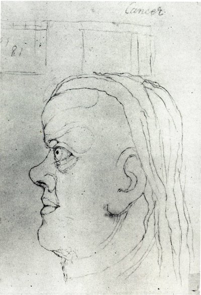 Leder af kræft af William Blake